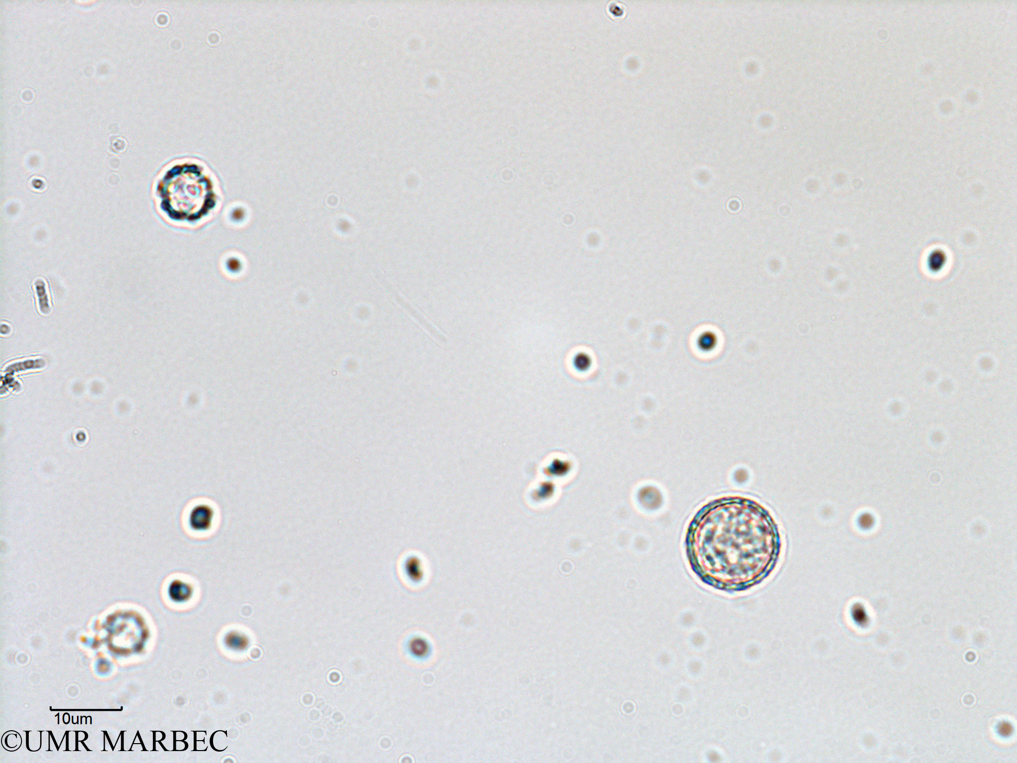 phyto/Bizerte/bizerte_bay/RISCO February 2015/Centrique spp 15-70µm (ancien Baie_T5-C2-Coccolitho spp-5).tif(copy).jpg